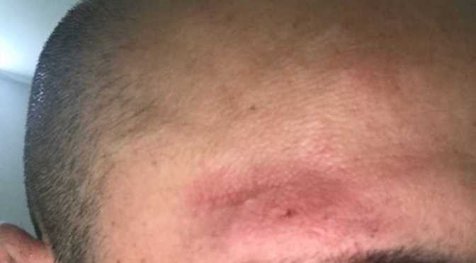 Polizia Locale: dichiarazione del Comando Generale su episodi di aggressione nei confronti degli agenti